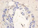 STAT6 Antibody in Immunohistochemistry (IHC)