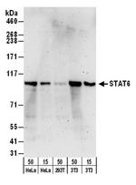 STAT6 Antibody in Western Blot (WB)