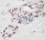 STAT6 Antibody in Immunohistochemistry (IHC)