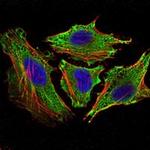 STAT6 Antibody in Immunocytochemistry (ICC/IF)