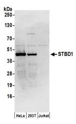 STBD1 Antibody in Western Blot (WB)