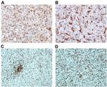 STING Antibody in Immunohistochemistry (IHC)