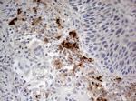 STK11 Antibody in Immunohistochemistry (Paraffin) (IHC (P))