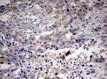 STK11 Antibody in Immunohistochemistry (Paraffin) (IHC (P))