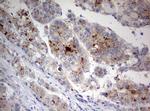 STK11 Antibody in Immunohistochemistry (Paraffin) (IHC (P))