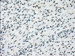 STK3 Antibody in Immunohistochemistry (Paraffin) (IHC (P))