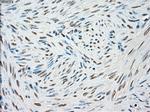 STK3 Antibody in Immunohistochemistry (Paraffin) (IHC (P))