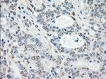 STK3 Antibody in Immunohistochemistry (Paraffin) (IHC (P))