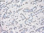 STK3 Antibody in Immunohistochemistry (Paraffin) (IHC (P))