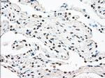 STK3 Antibody in Immunohistochemistry (Paraffin) (IHC (P))