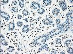 STK3 Antibody in Immunohistochemistry (Paraffin) (IHC (P))