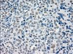 STK3 Antibody in Immunohistochemistry (Paraffin) (IHC (P))