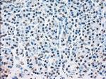 STK3 Antibody in Immunohistochemistry (Paraffin) (IHC (P))