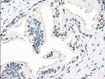 STK3 Antibody in Immunohistochemistry (Paraffin) (IHC (P))