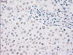 STK3 Antibody in Immunohistochemistry (Paraffin) (IHC (P))