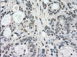 STK3 Antibody in Immunohistochemistry (Paraffin) (IHC (P))