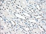 STK3 Antibody in Immunohistochemistry (Paraffin) (IHC (P))