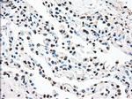 STK3 Antibody in Immunohistochemistry (Paraffin) (IHC (P))