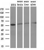 STK3 Antibody in Western Blot (WB)