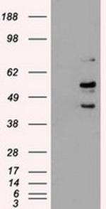 STK3 Antibody in Western Blot (WB)