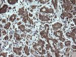 STK38L Antibody in Immunohistochemistry (Paraffin) (IHC (P))