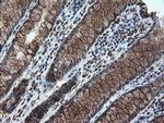 STK38L Antibody in Immunohistochemistry (Paraffin) (IHC (P))