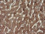 STK38L Antibody in Immunohistochemistry (Paraffin) (IHC (P))