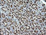 STK38L Antibody in Immunohistochemistry (Paraffin) (IHC (P))