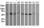 STK38L Antibody in Western Blot (WB)