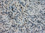 STK39 Antibody in Immunohistochemistry (Paraffin) (IHC (P))