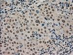 STK39 Antibody in Immunohistochemistry (Paraffin) (IHC (P))