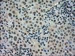 STK39 Antibody in Immunohistochemistry (Paraffin) (IHC (P))