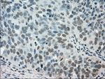 STK39 Antibody in Immunohistochemistry (Paraffin) (IHC (P))