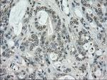 STK39 Antibody in Immunohistochemistry (Paraffin) (IHC (P))