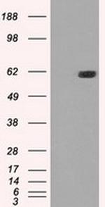 STK39 Antibody in Western Blot (WB)