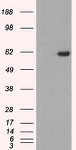 STK39 Antibody in Western Blot (WB)