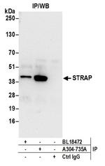 STRAP Antibody in Western Blot (WB)