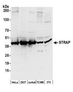 STRAP Antibody in Western Blot (WB)