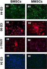 STRO-1 Antibody in Immunocytochemistry (ICC/IF)