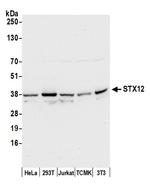 STX12 Antibody in Western Blot (WB)