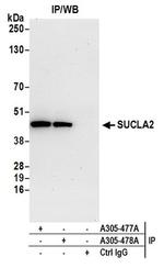 SUCLA2 Antibody in Western Blot (WB)