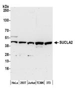 SUCLA2 Antibody in Western Blot (WB)