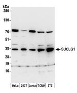 SUCLG1 Antibody in Western Blot (WB)
