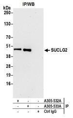 SUCLG2 Antibody in Western Blot (WB)