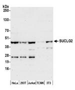 SUCLG2 Antibody in Western Blot (WB)