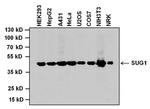 PSMC5 Antibody in Western Blot (WB)