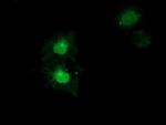 SULT1A1 Antibody in Immunocytochemistry (ICC/IF)