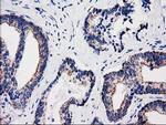 SULT1A1 Antibody in Immunohistochemistry (Paraffin) (IHC (P))