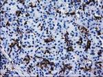 SULT1A1 Antibody in Immunohistochemistry (Paraffin) (IHC (P))