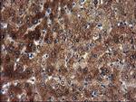 SULT1A1 Antibody in Immunohistochemistry (Paraffin) (IHC (P))